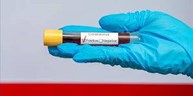 COVID-19 TESTING ( PCR testing and Rapid antigen test)
